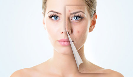 Skin Care Medication